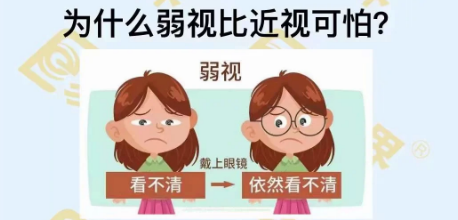 為什么弱視比近視可怕？