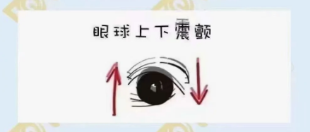 什么是眼球震顫？