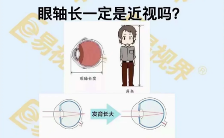 眼軸長一定是近視嗎？